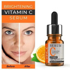 Dark Sport Removal Vitamin-C SerumVince 1 haseen.store